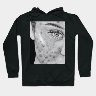 drawing insecurities acne pimples body positivity Hoodie